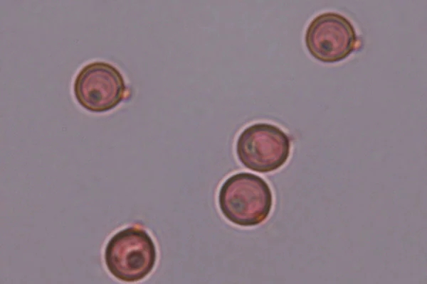 Spore al Rosso Congo ammoniacale in Bovistella utriformis (Obiettivo 100 x)