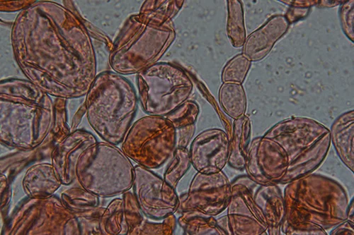 Esostrato in Bovistella utriformis