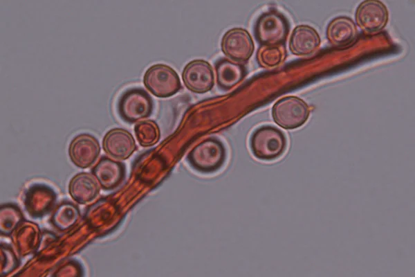 Parte del capillizio, con spore adese sulle pareti in Bovistella utriformis