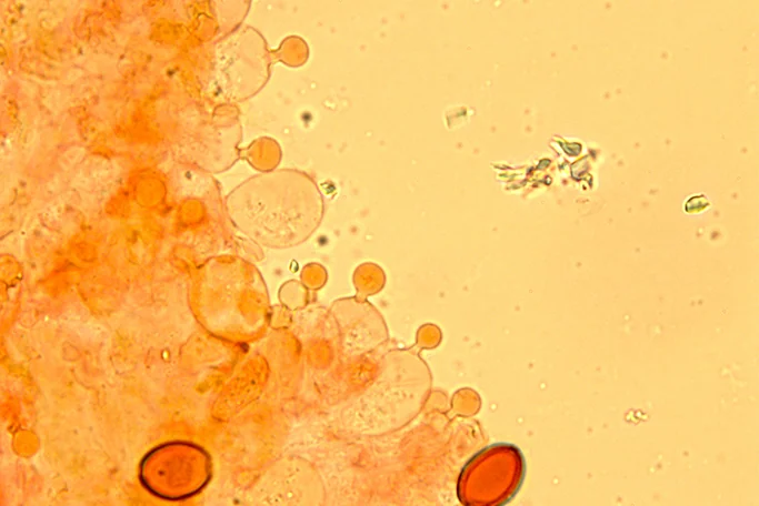 Conocybe fuscimarginata - Cheilocistidi lecitiformi- (Obiettivo 100 x)