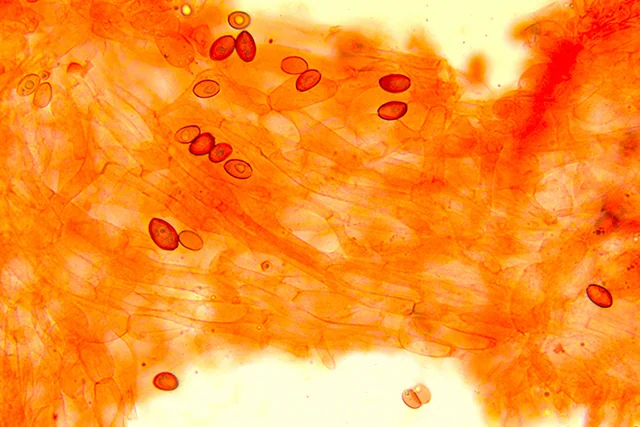 Conocybe fuscimarginata - Ife della caulocute: osservazione al Rosso Congo ammoniacale. (Obiettivo 40 x)