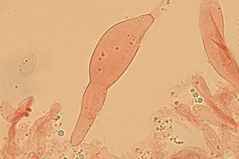 Flammulina ononidis Arnolds - Cheilocistide: colorazione al Rosso Congo ammoniacale (Obiettivo 100 x)