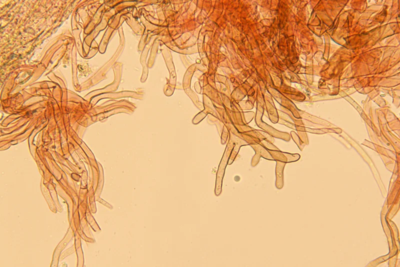 Flammulina ononidis Arnolds - Pileipellis (Obiettivo 100 x)