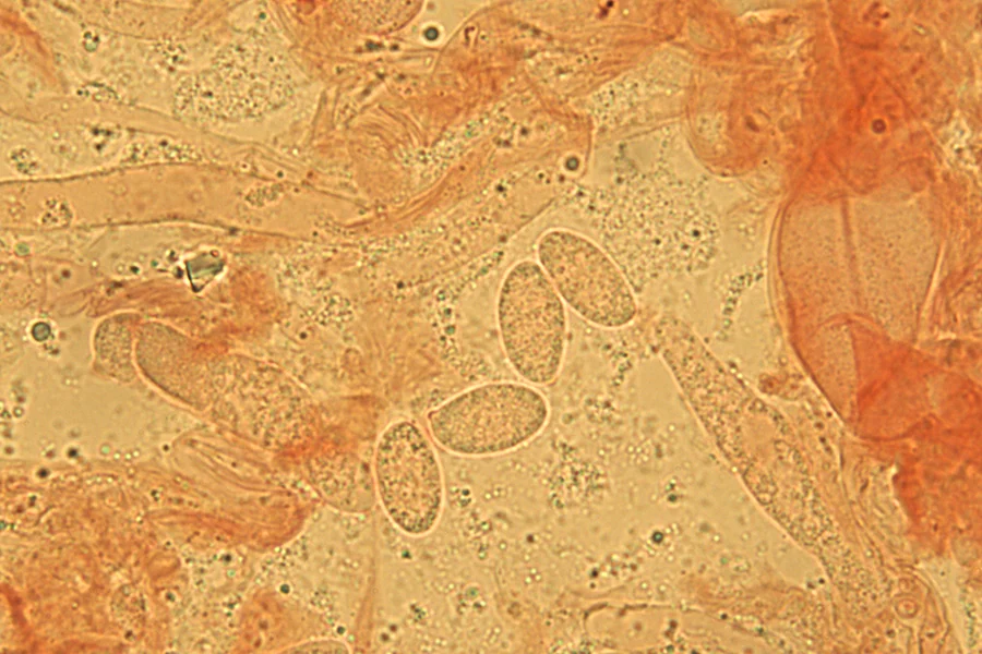 Flammulina ononidis Arnolds - Spore al Rosso Congo ammoniacale (Obiettivo 100 x)
