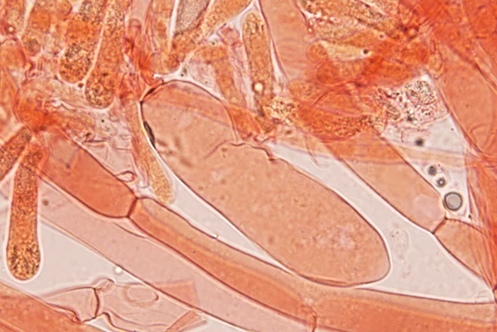 Floccularia luteovirens - Pileipellis - (Obiettivo 100 x)