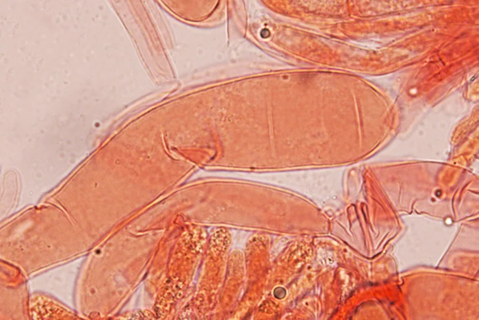 Floccularia luteovirens - Pileipellis -(Obiettivo 100 x)