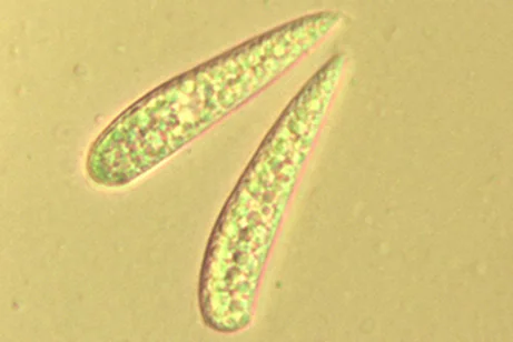 Hymenoscyphus serotinus (Pers.) W. Phillips - Spore- Osservazione in luce trasmessa (Obiettivo 100 x)