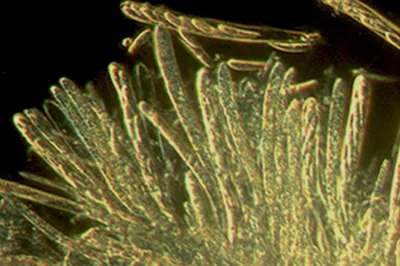 Hymenoscyphus serotinus (Pers.) W. Phillips - Aschi- Osservazione in campo chiaro (Obiettivo 20 x)