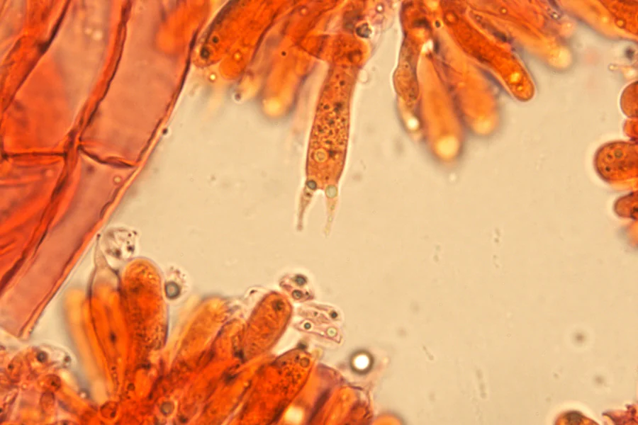 Phloeomana hiemalis (Osbeck) Redhead - Basidio bisporico (Obiettivo 100 x)