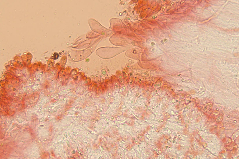 Phloeomana hiemalis (Osbeck) Redhead - Caulocute (Obiettivo 40 x)