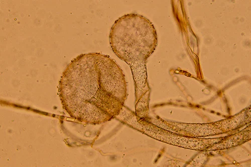 Rhizopus stolonifer (Ehrenb.) Vuill. - Sporangi, sporangiofori e columella, al Rosso Congo ammoniacale (Obiettivo 40 x)