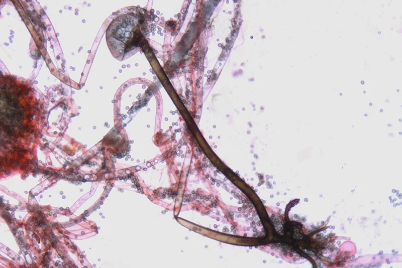 Rhizopus stolonifer (Ehrenb.) Vuill. - Sporangio con sporangioforo