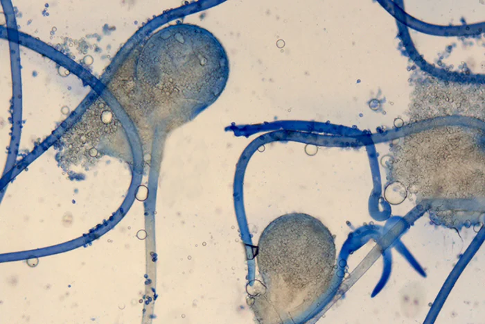 Rhizopus stolonifer (Ehrenb.) Vuill. - Sporangiofori: colorazione con blu cotone in lattofenolo (Obiettivo 40 x)