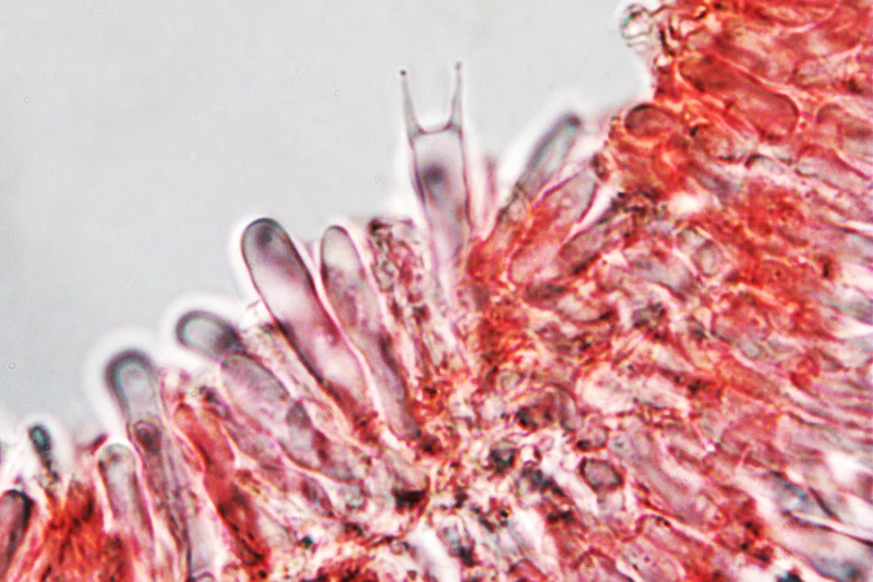 Schizophyllum commune Fr. - Struttura imeniale; colorazione al Rosso Congo anionico. (Obiettivo 40 x)