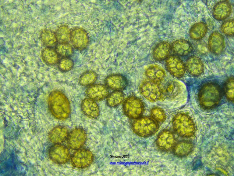 Spore in asco in Tub aestivum. Colorazione al Nero amido 10 B. (OB. 40 x)