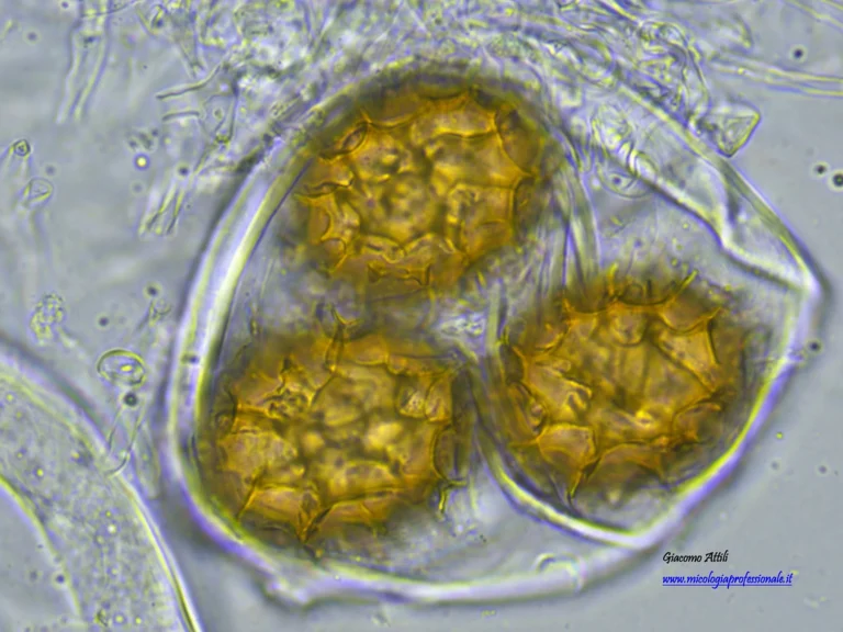 Spore in asco in Tuber aestivum. Osservazione tal quale (OB. 100 x)