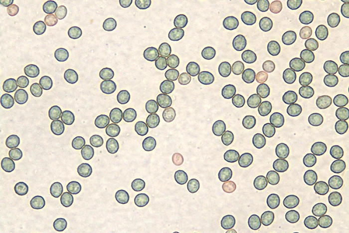 Trichoderma viride Pers. - Conidi; (Obiettivo 100 x)