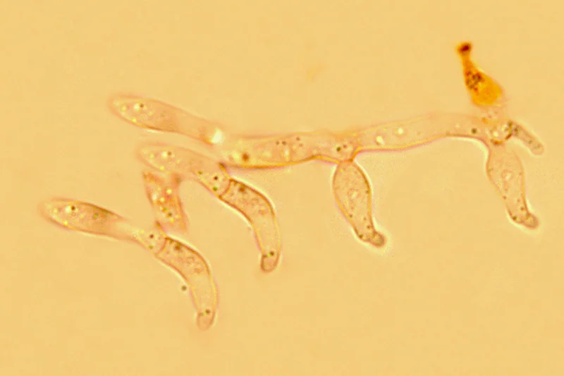 Trichoderma viride Pers. - (Frammenti di conidioforo)