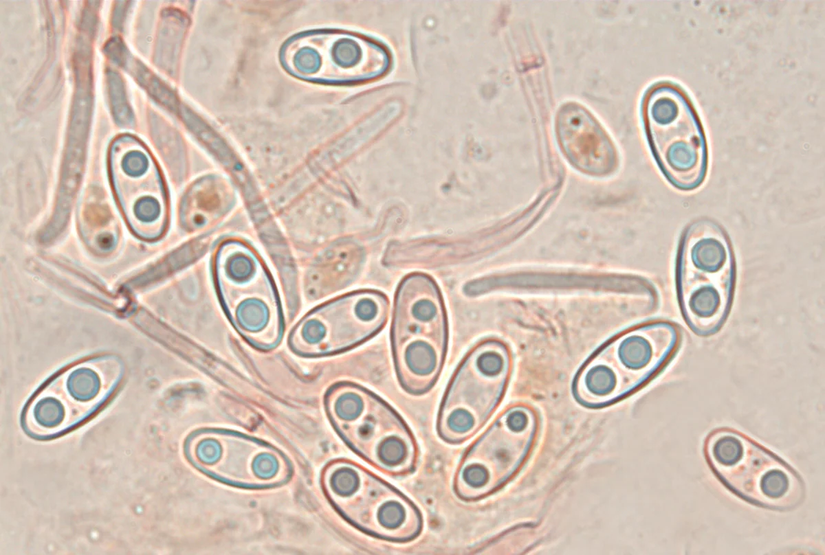 spore di Otidea onotica (colorazione al Rosso Congo ammoniacale - obiettivo 100 x)